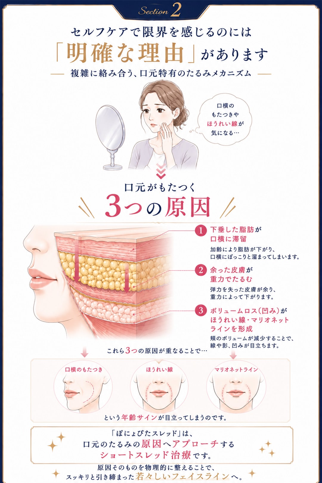複雑に絡み合う、口元特有のたるみメカニズム<br />

