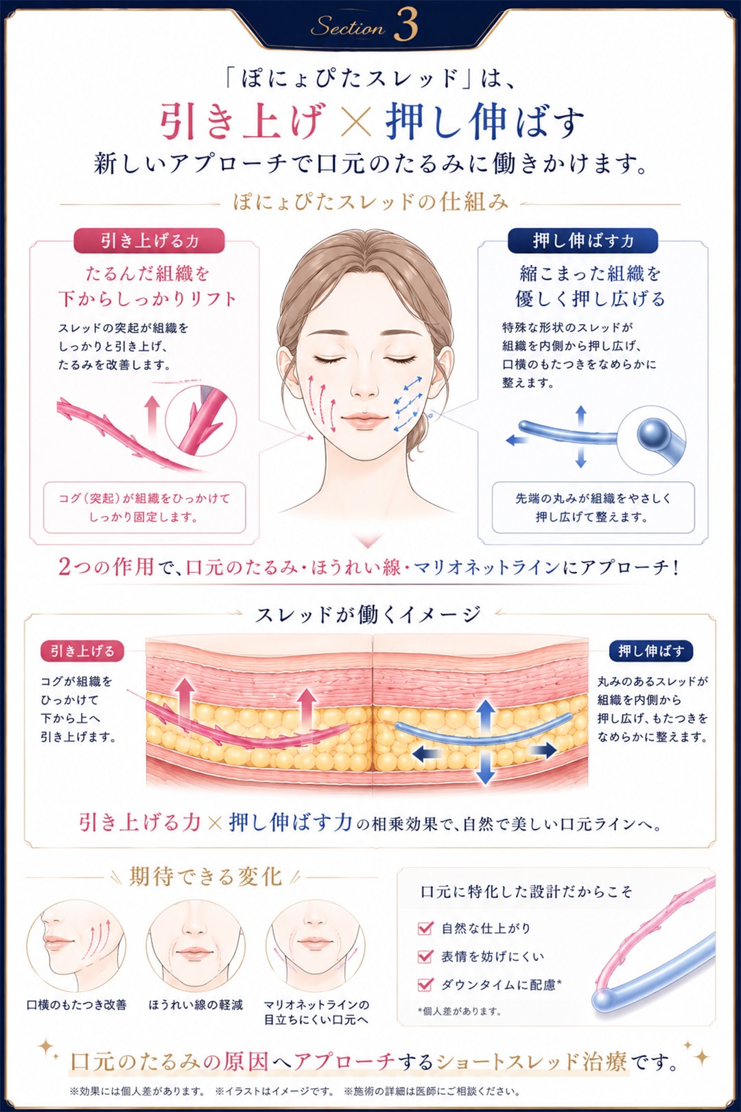 なぜ『ぽにょぴたスレッド』は口横のもたつきに劇的に効くのか？