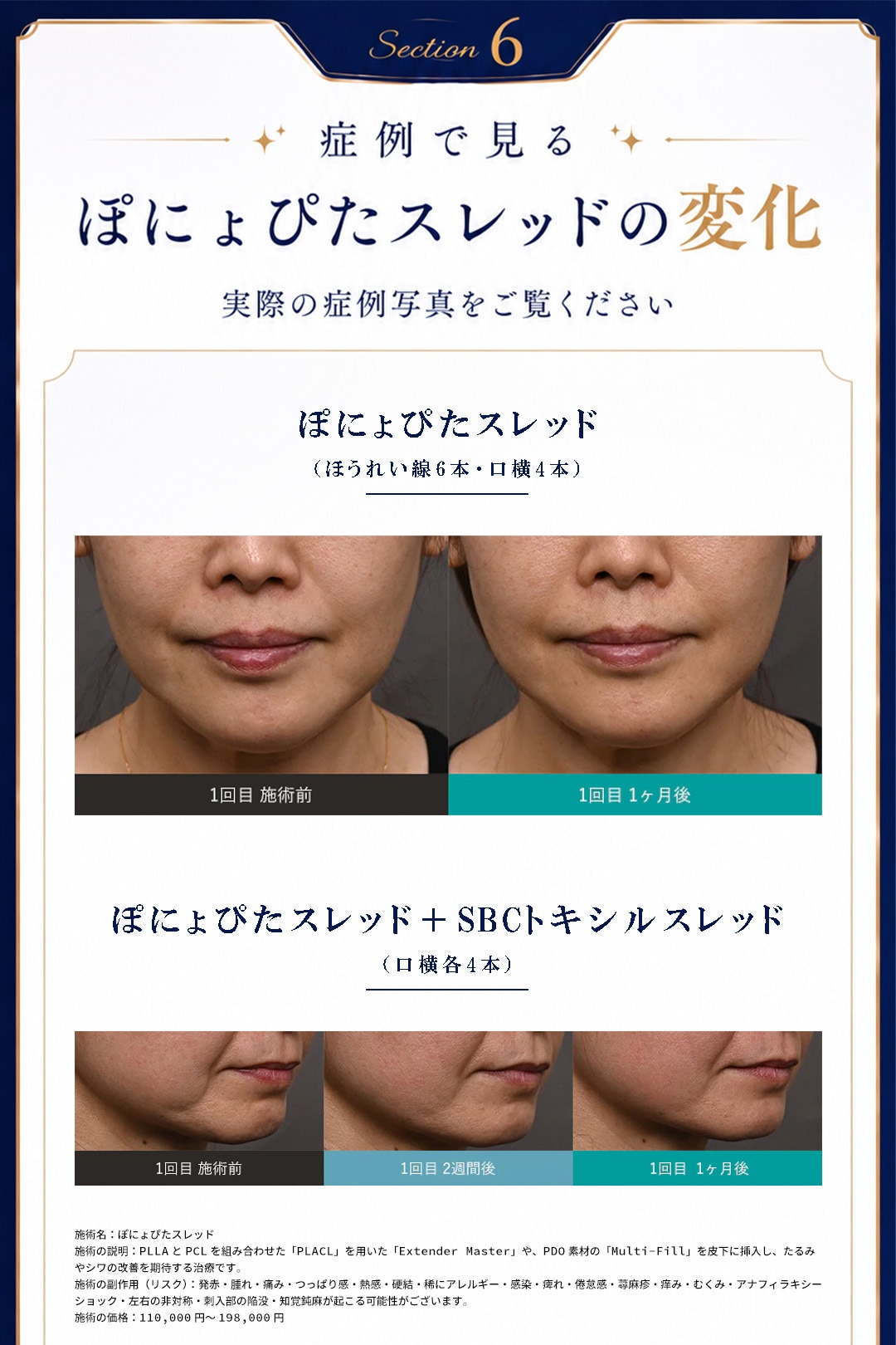 Before＆After