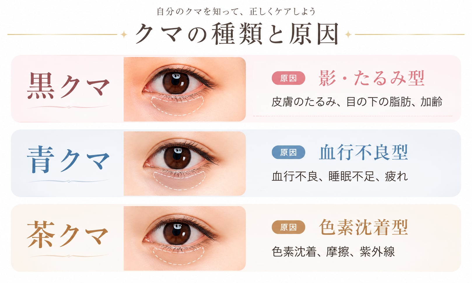 3つの種類と原因