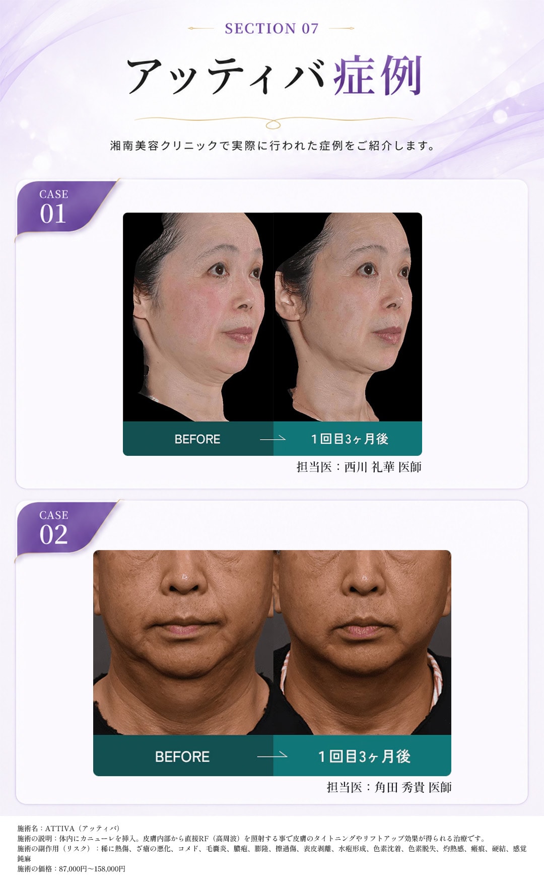 Before＆After