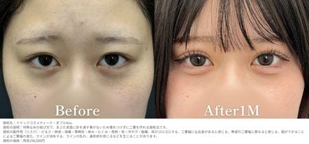 人気No. 1🩷MIX型