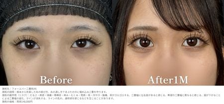 華やかに映える目元💜平行型