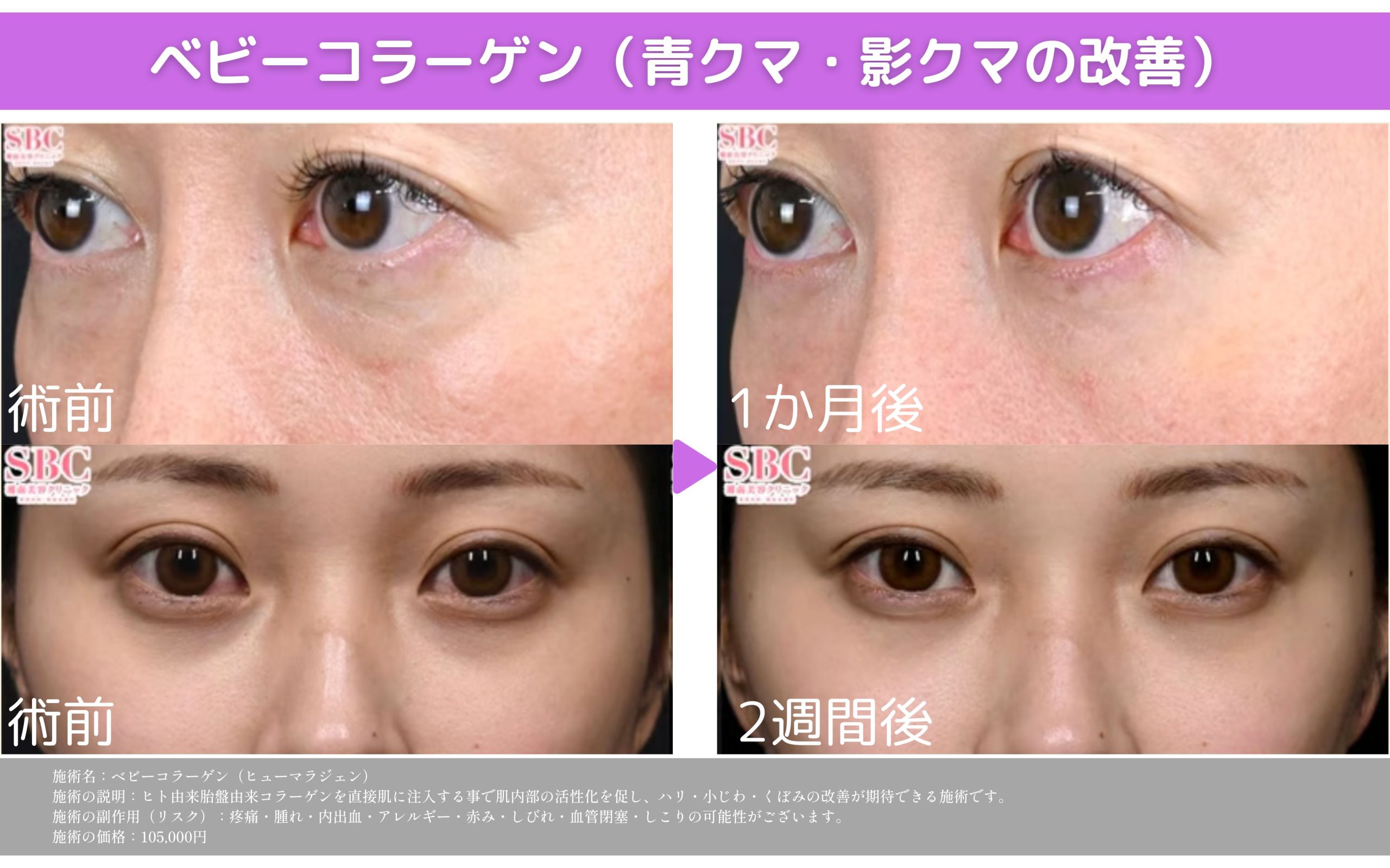 【ベビーコラーゲン】赤ちゃんのプルプル感を再現👶✨