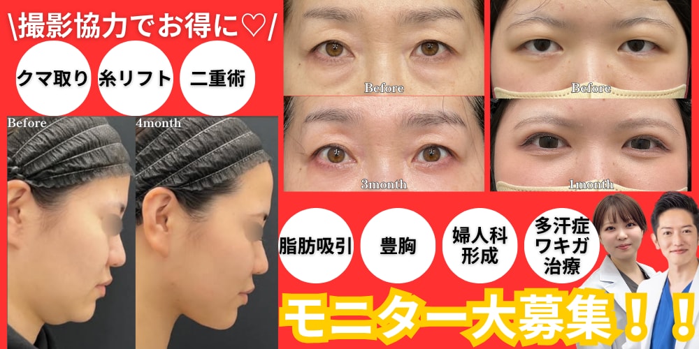 クマ改善や若返り・たるみ改善・二重など長崎院のモニター募集一覧