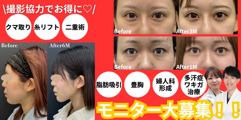 クマ改善や若返り・たるみ改善・二重など長崎院のモニター募集一覧