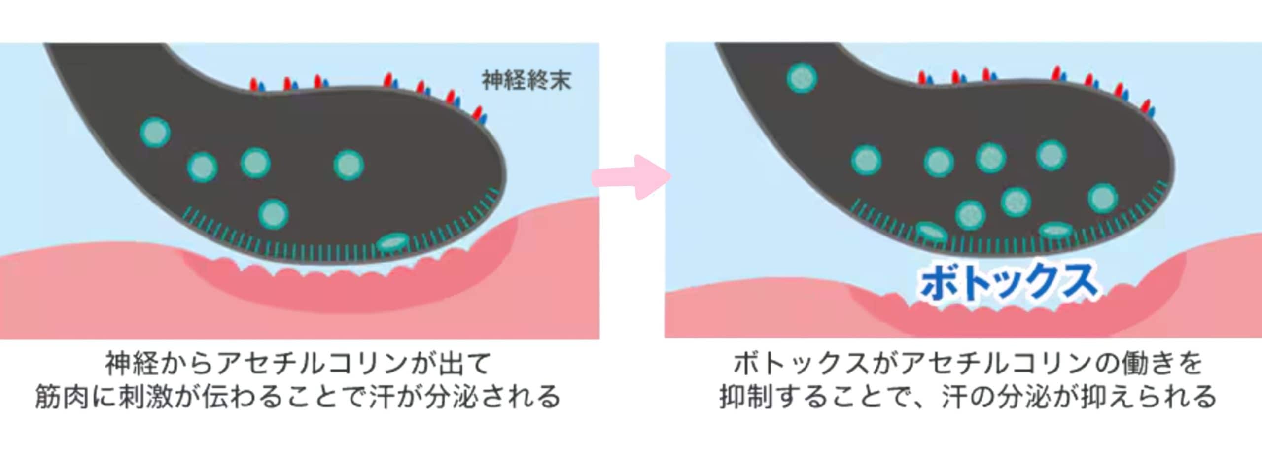 じっとり汗・洋服のシミにサヨナラ。夏本番までずーっとノースリーブを快適に