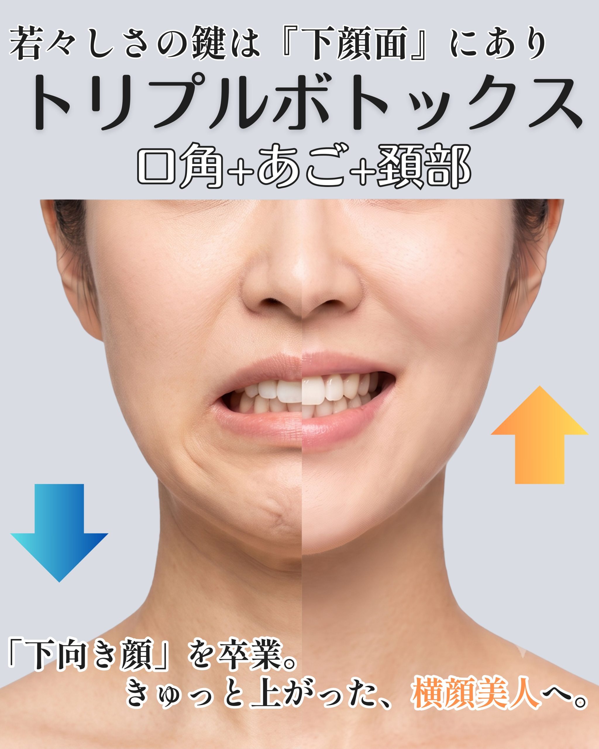 「なぜ、ボトックスでリフトアップするの？」