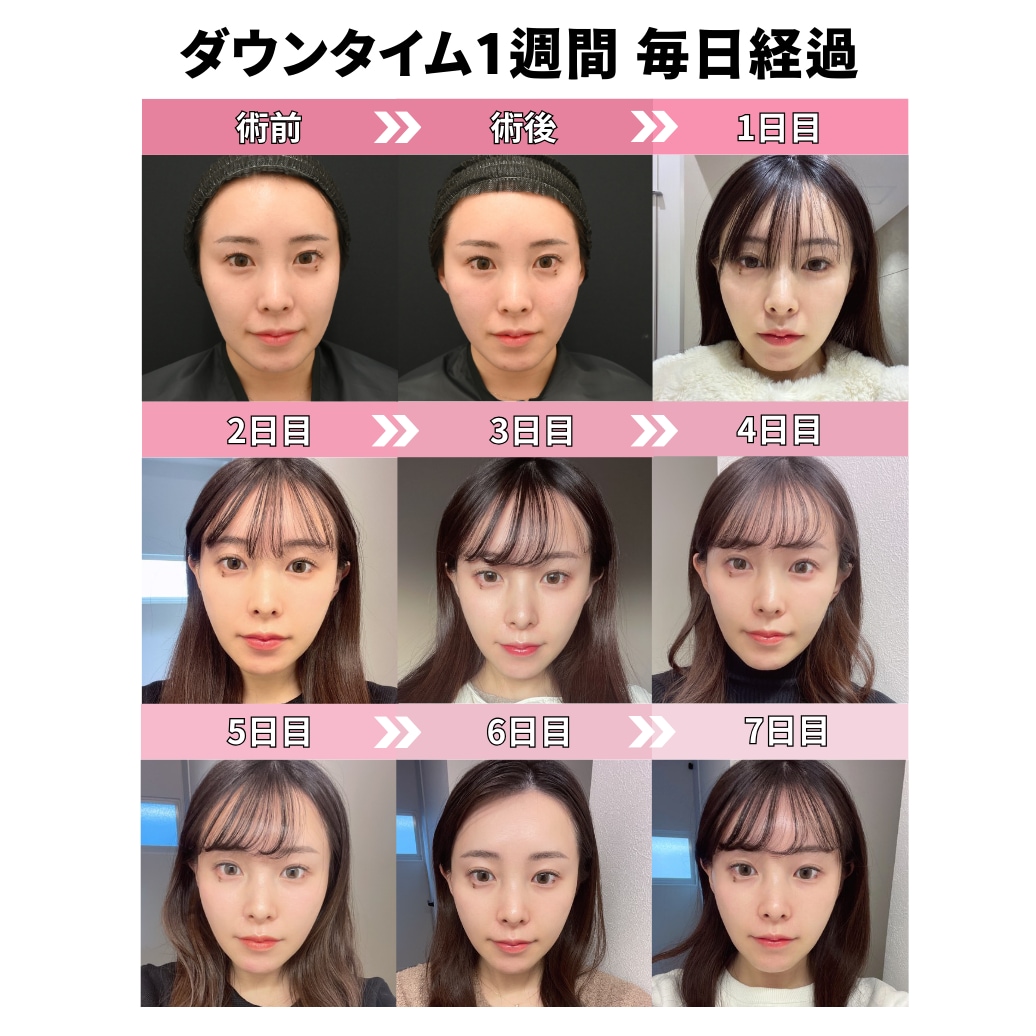実際のダウンタイム
