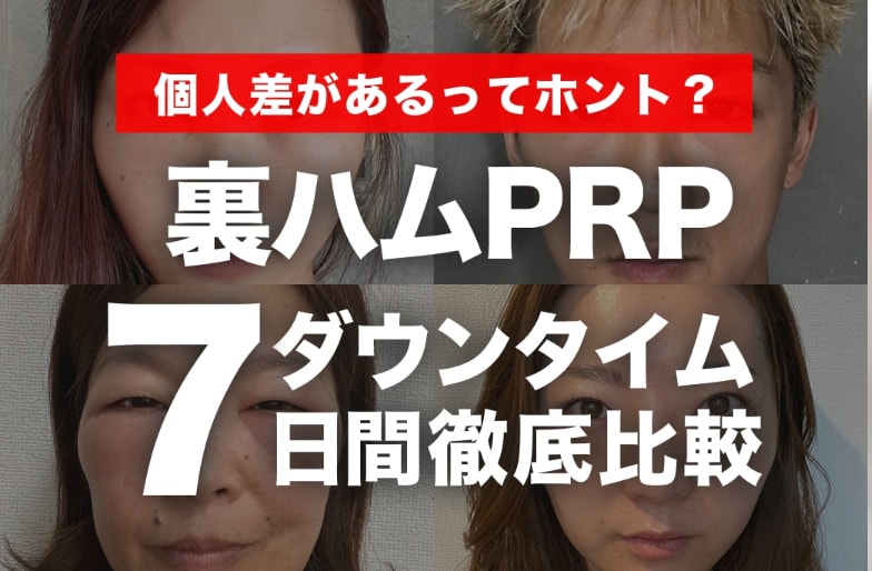 【超貴重】クマ取りダウンタイム徹底比較！【執刀医：名古屋のクマ取り名医”高川医師”】