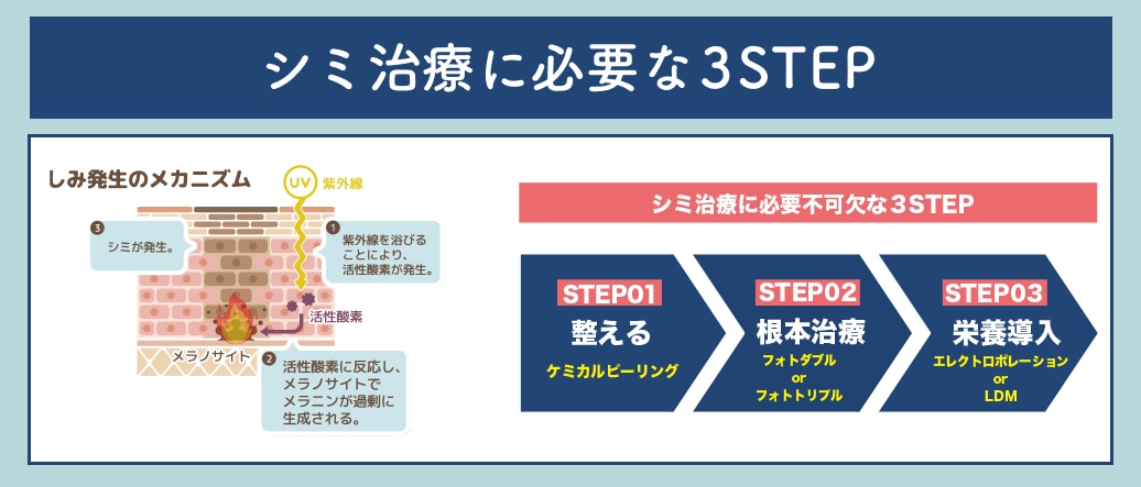 シミ治療に必要不可欠な３STEP