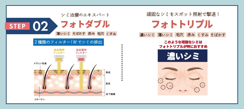 根本治療でシミを撃退！