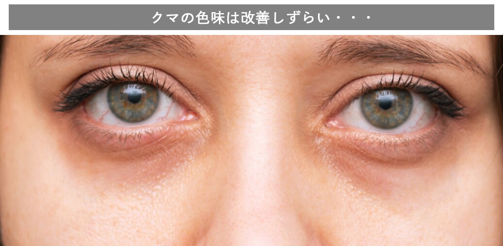 色グマが治しにくい理由