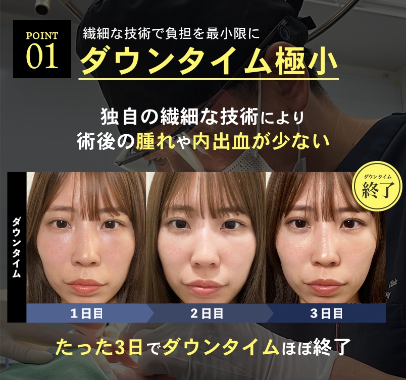 【ダウンタイム極小】繊細な技術で負担を最小限に