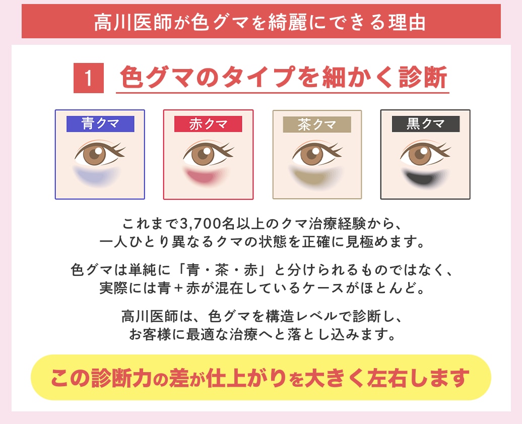 色グマ治療のスペシャリストのこだわり