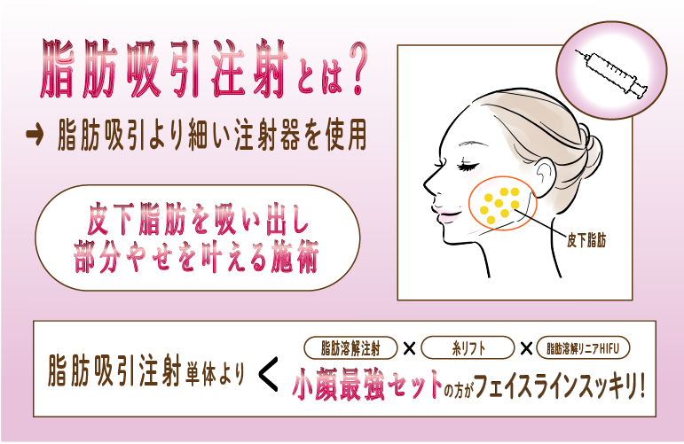 【脂肪吸引注射とは】