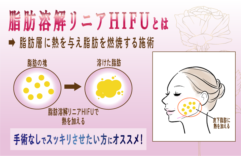 【最強小顔セット】-脂肪溶解リニアハイフ①-