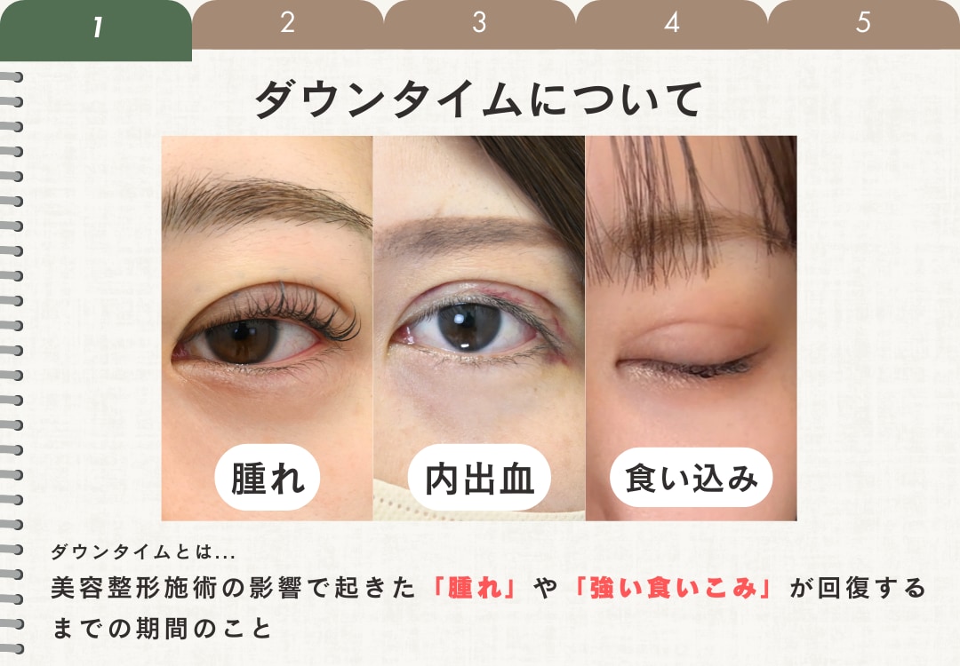 ダウンタイムを最短にする『正しい知識』