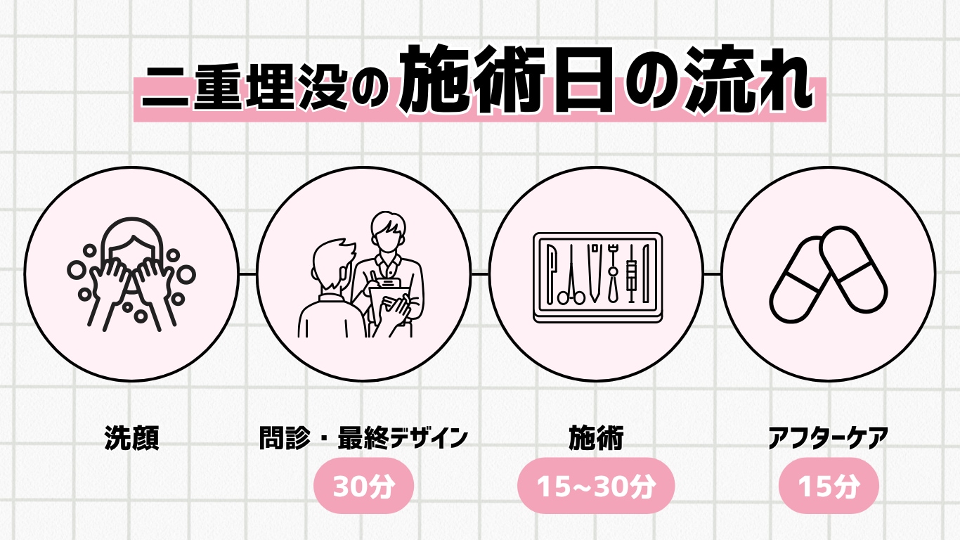 二重整形当日の流れ