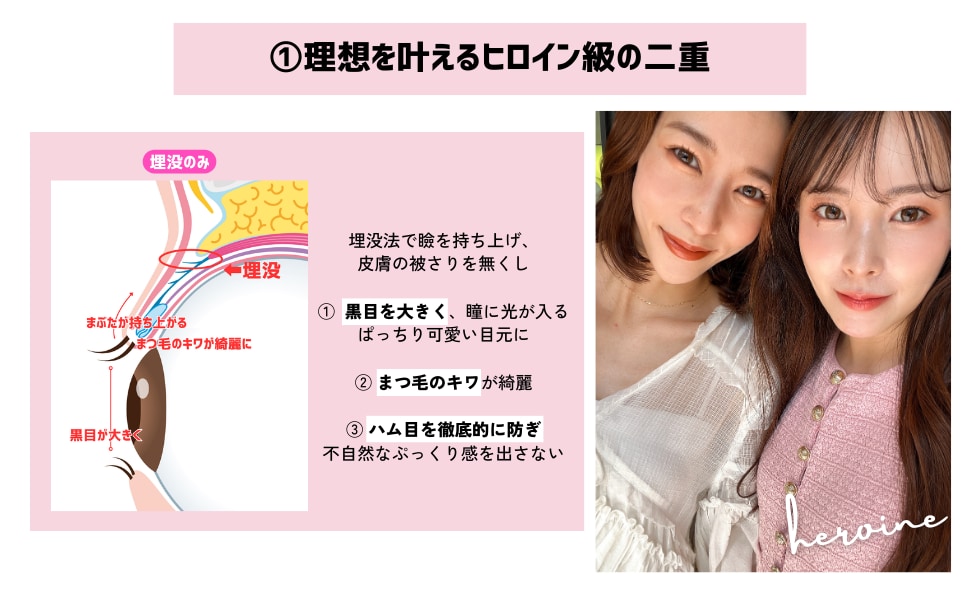 高川選ばれる理由①理想を叶える二重術