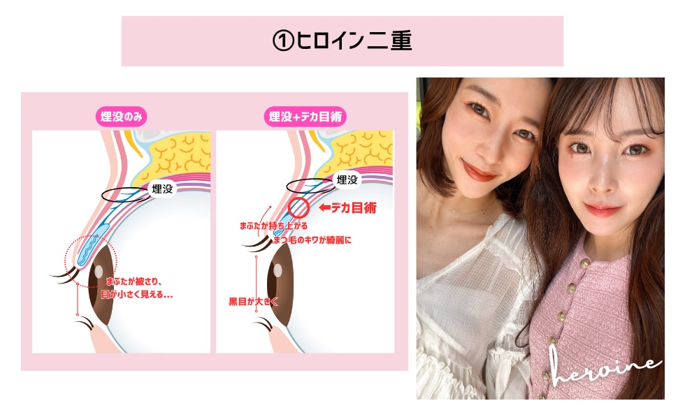 高川選ばれる理由①ヒロイン二重