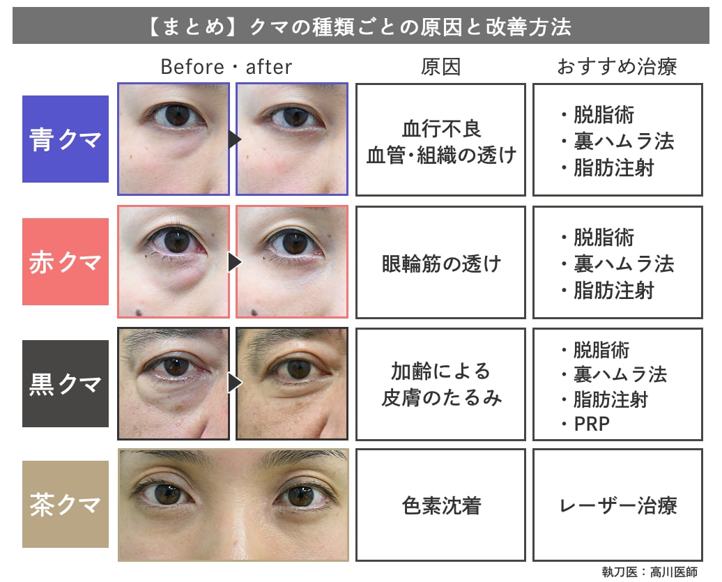 【種類別】原因・改善法まとめ
