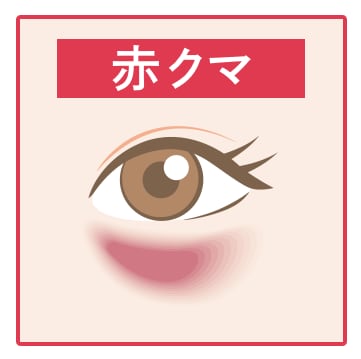 赤クマ