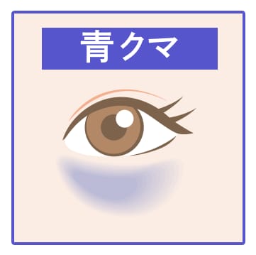 青クマ