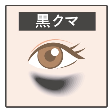 黒クマ