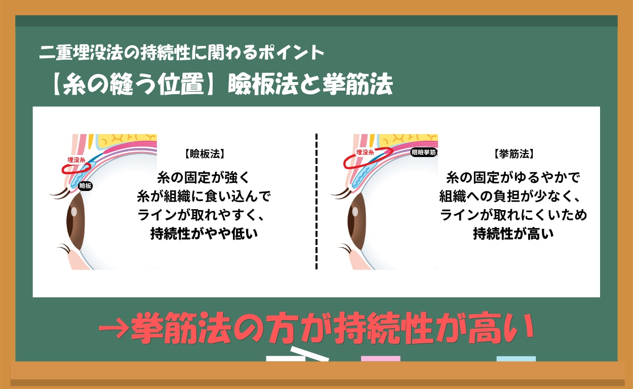 持続性【糸の縫う位置】