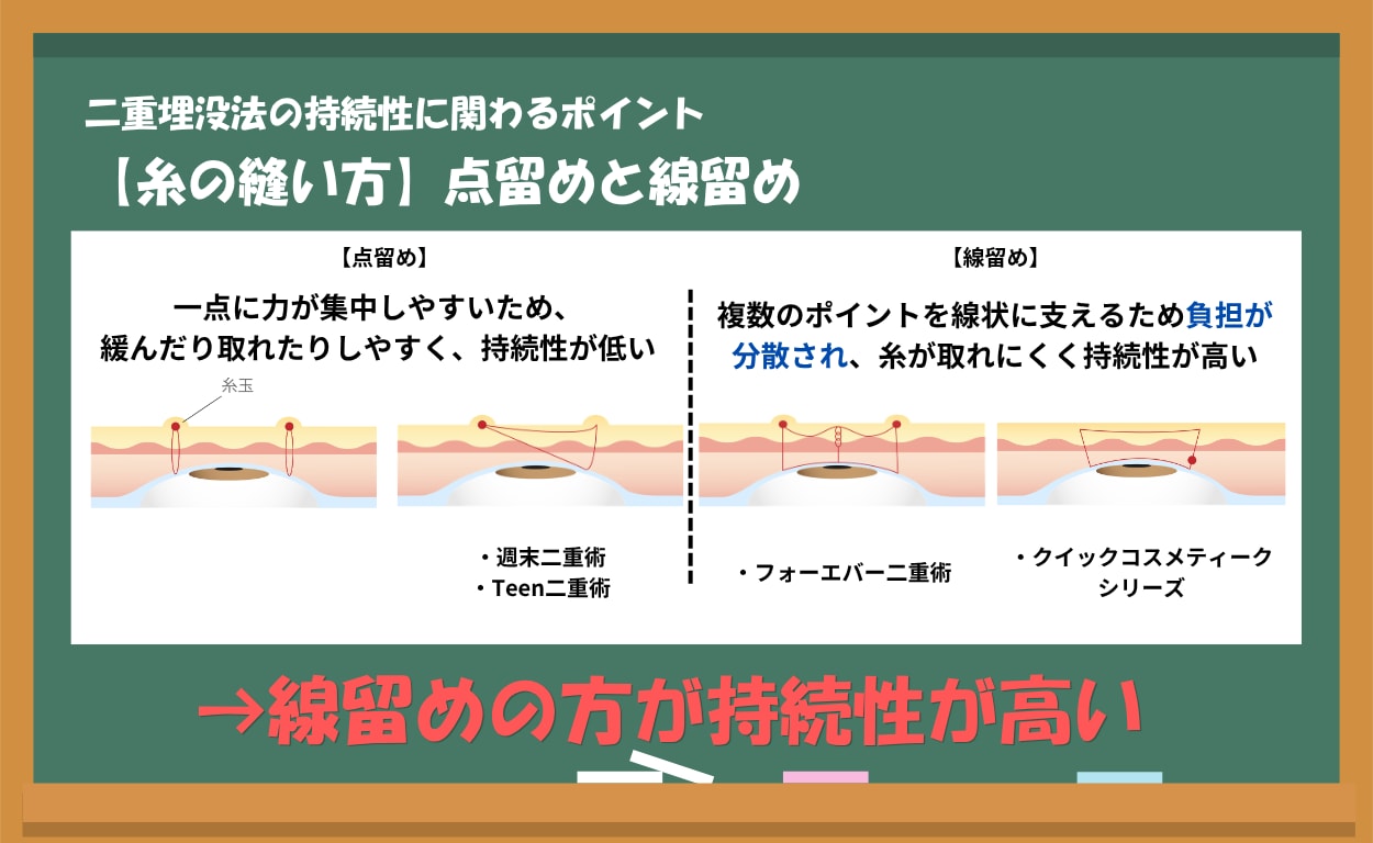 持続性【糸の縫い方】