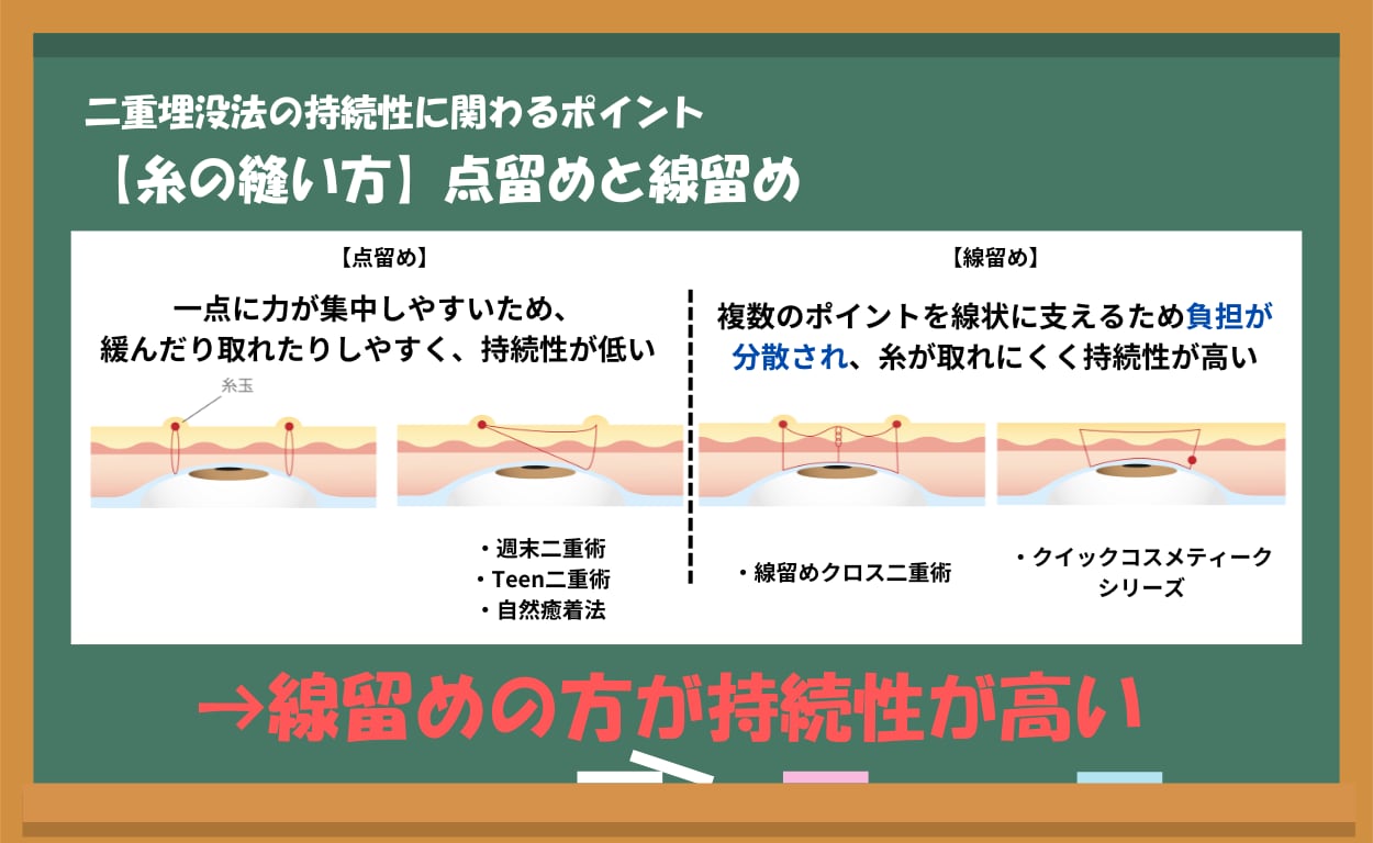 持続性【糸の縫い方】