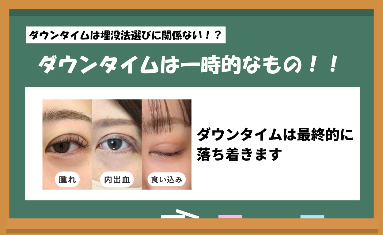 ダウンタイムは一時的なもの