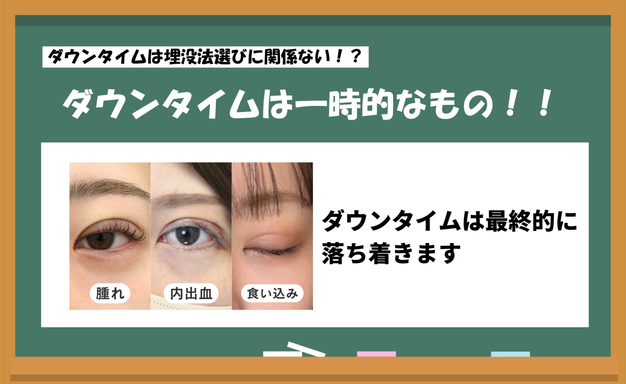 ダウンタイムは一時的なもの