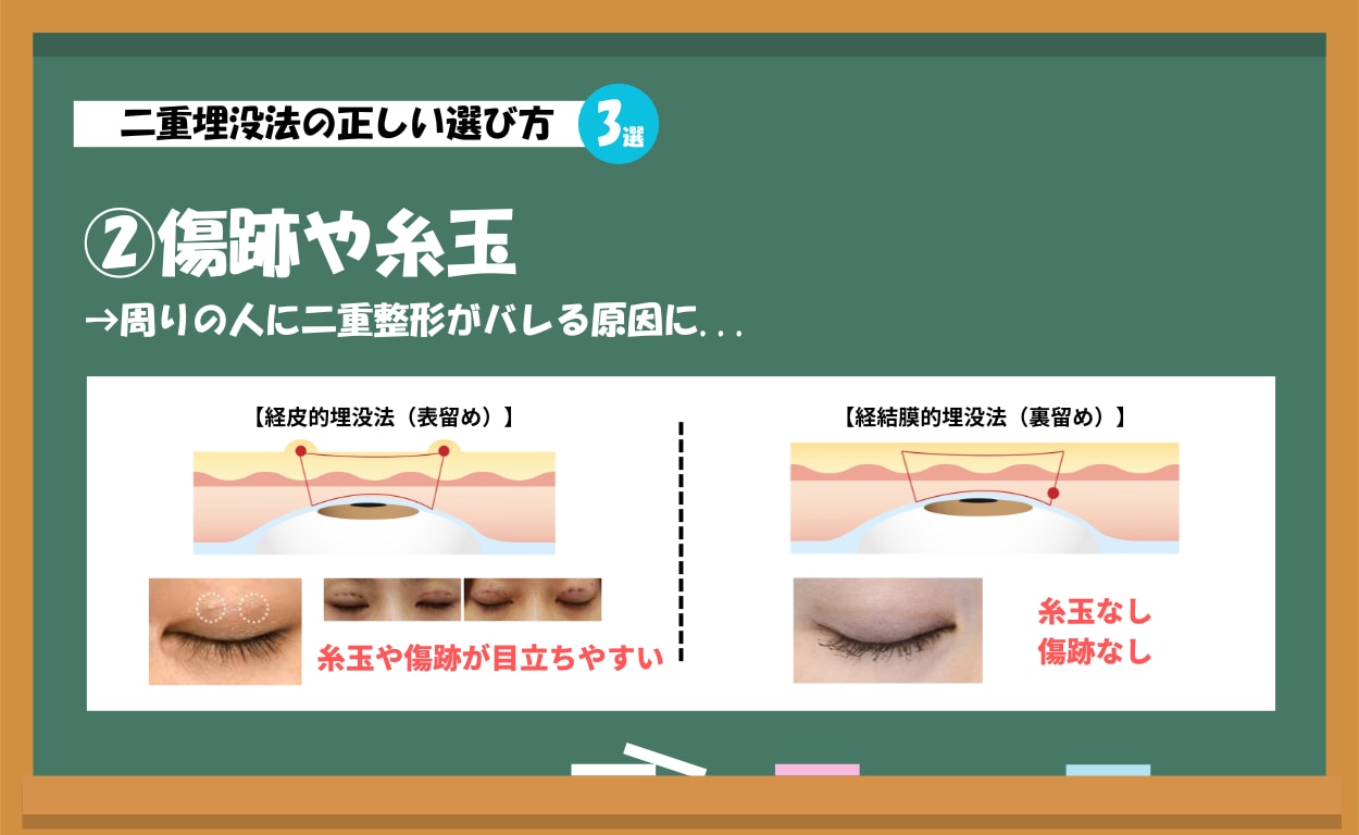 ②傷跡や糸玉