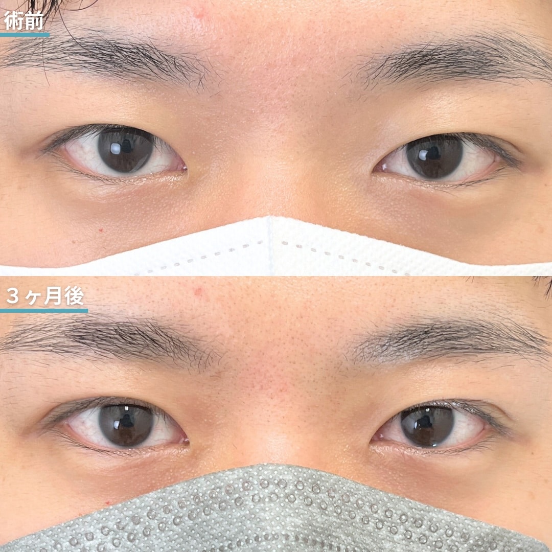 【20代・会社員】忙しい社会人のための最短ダウンタイム