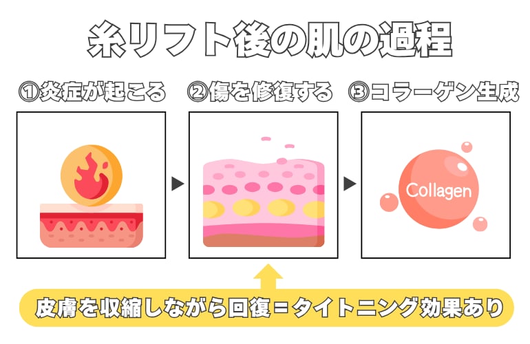 未来のたるみ予防
