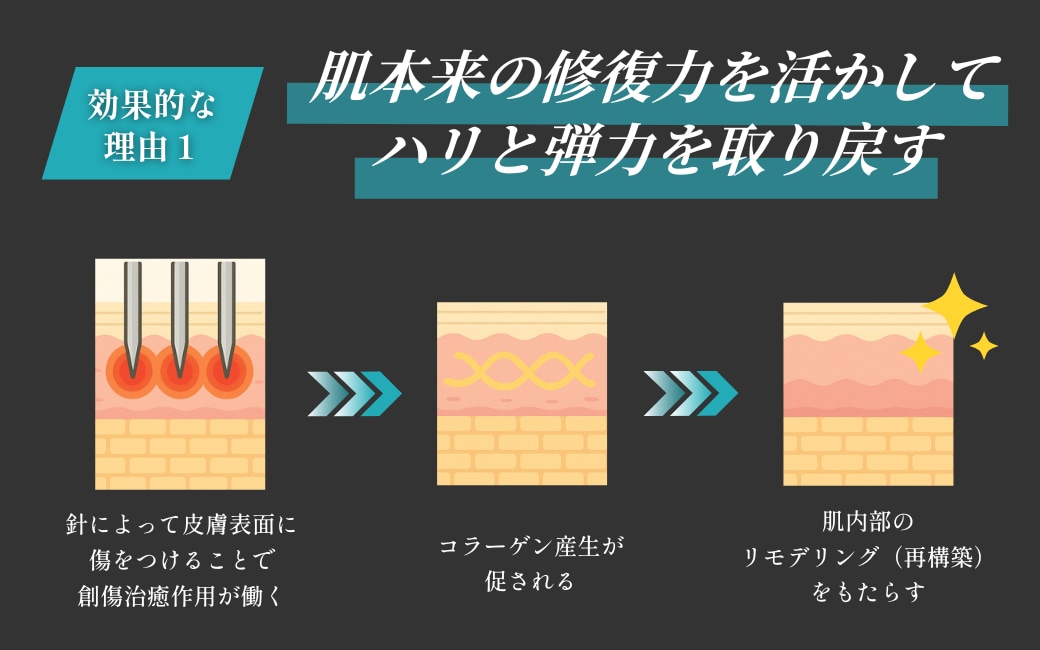 なぜ、モフィウス8がクマに効果的なの?
