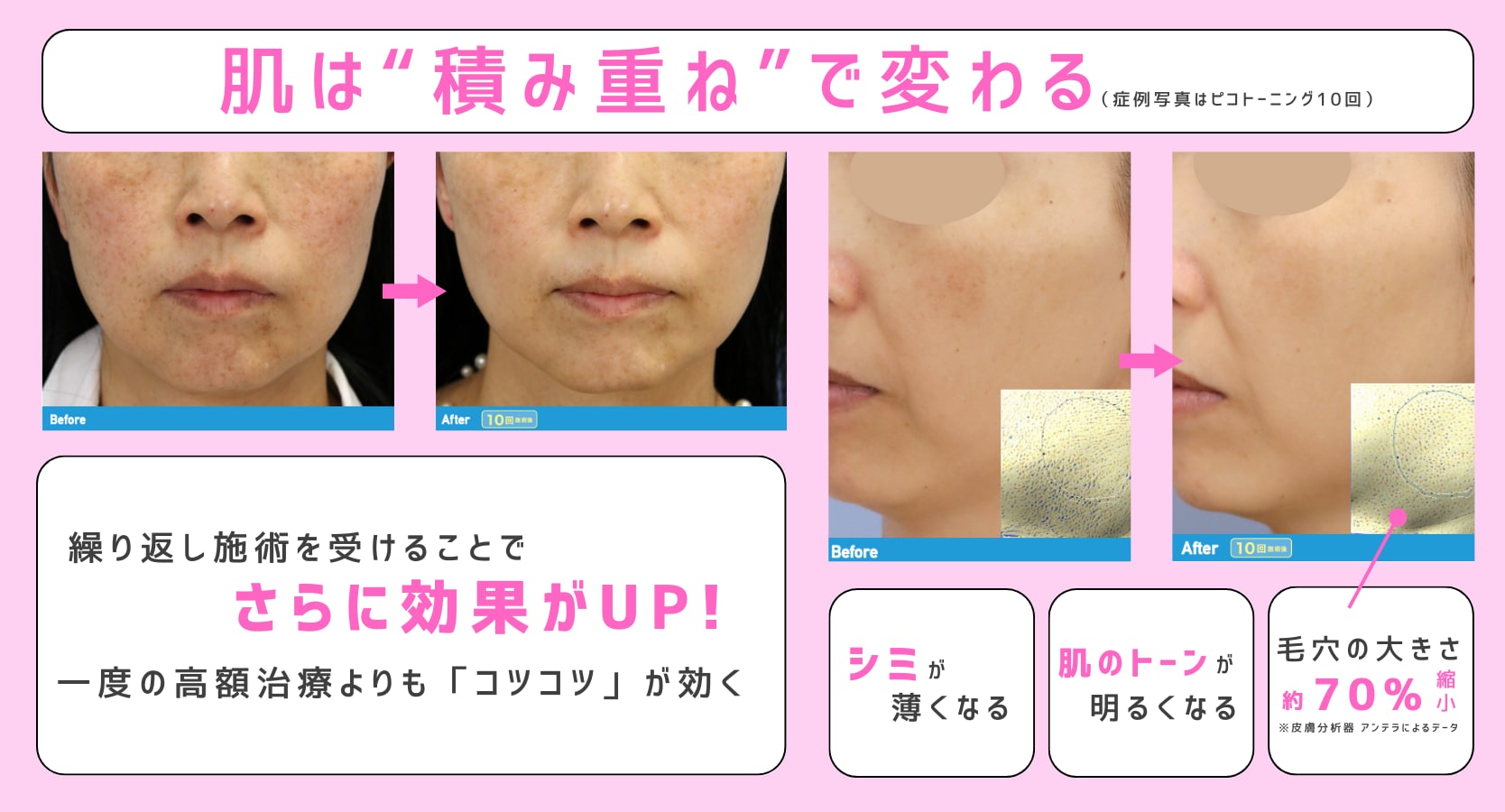 一度の高額治療よりも「コツコツ」が効く理由