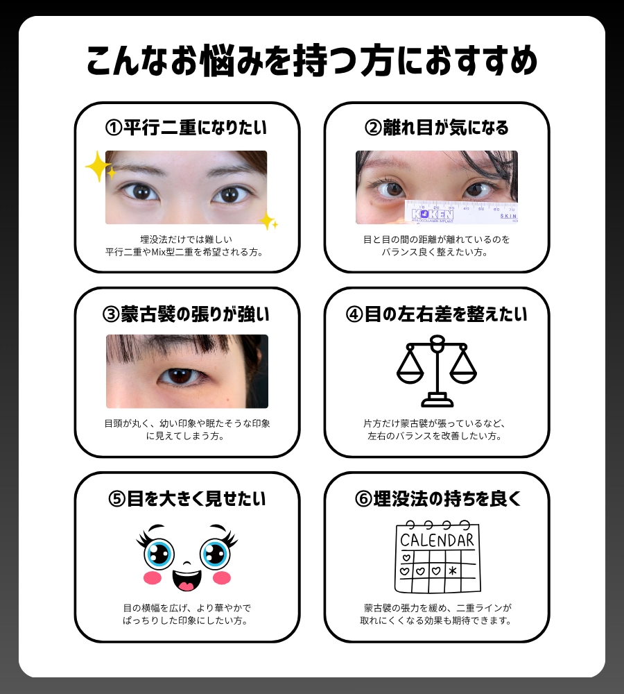 あなたは目頭切開適用？