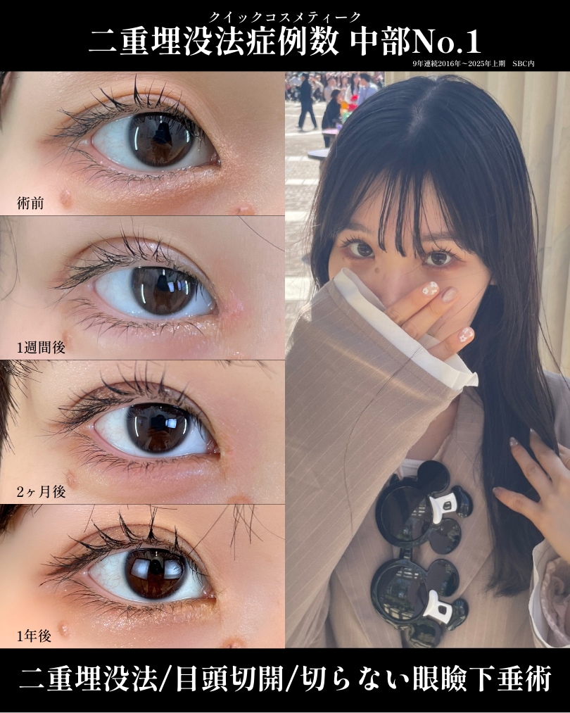 二重整形との最適な組み合わせ提案