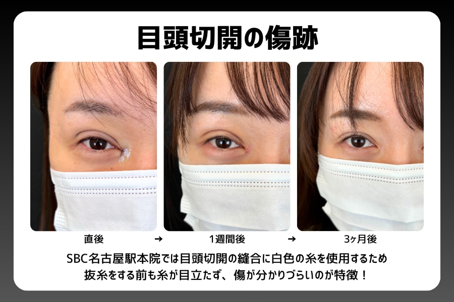 最小限のダウンタイムと傷跡への配慮