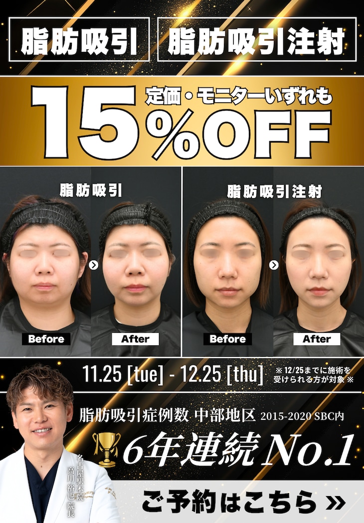 脂肪吸引15%OFF