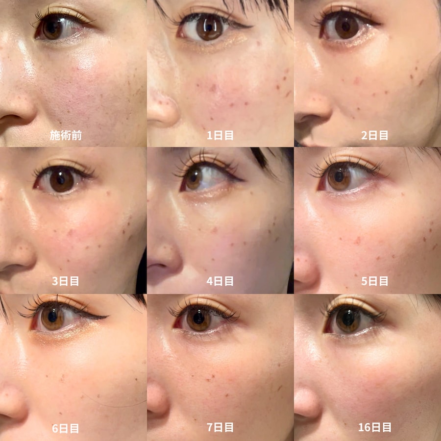 リアルに言うと👇