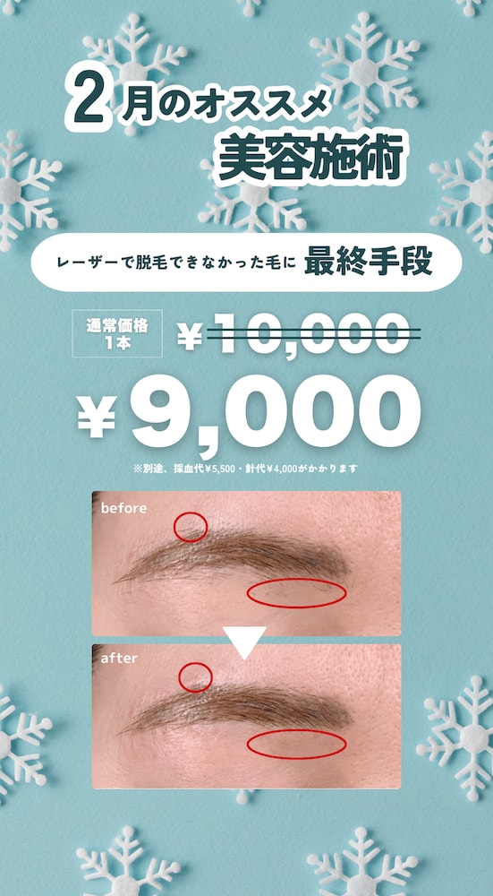 ニードル脱毛がお得🉐