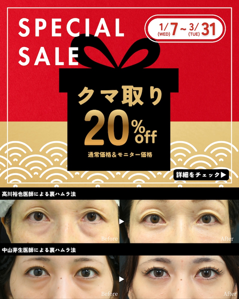 クマ取り20%OFF