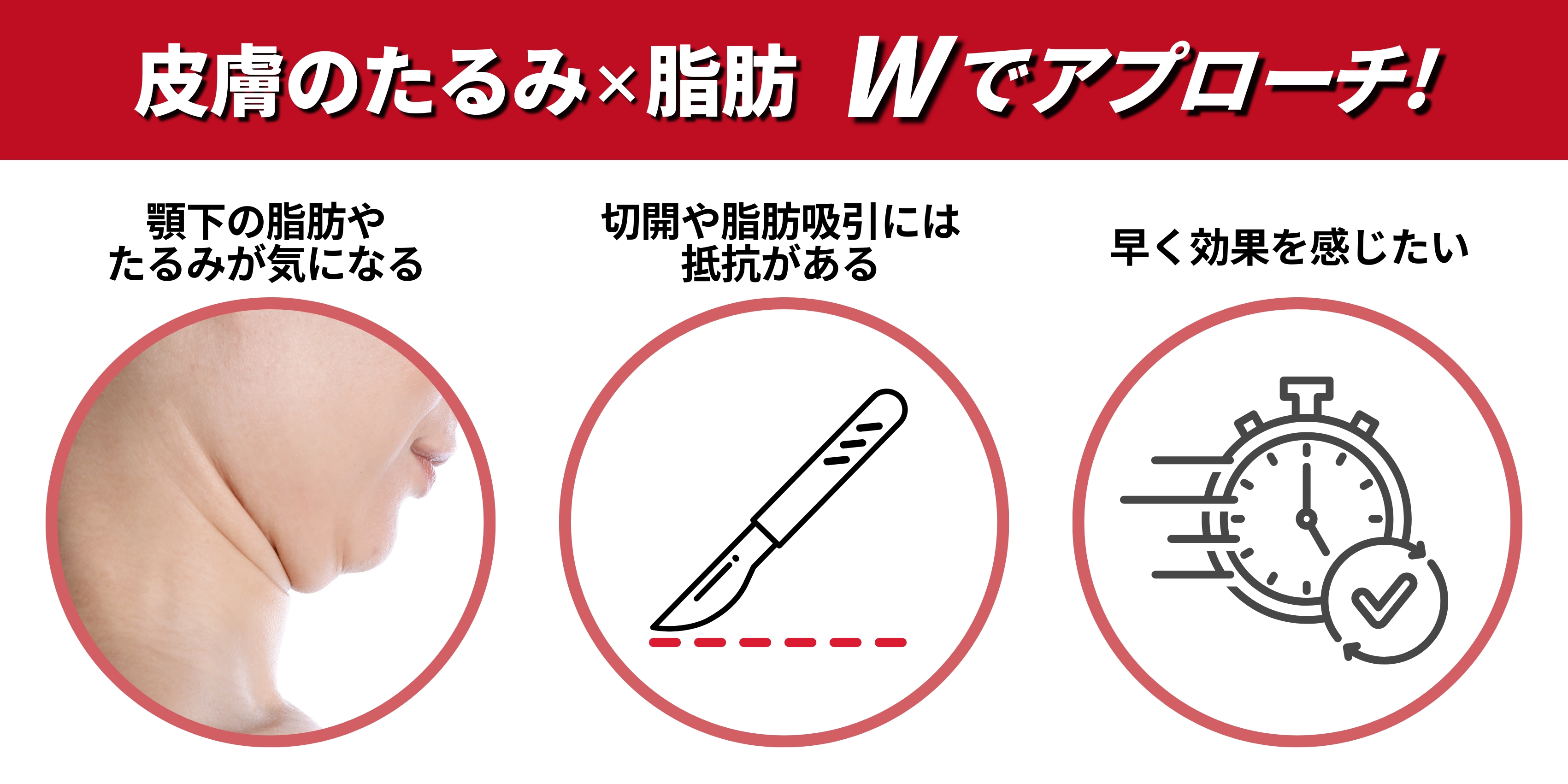 顎下すっきリフトがおすすめな人