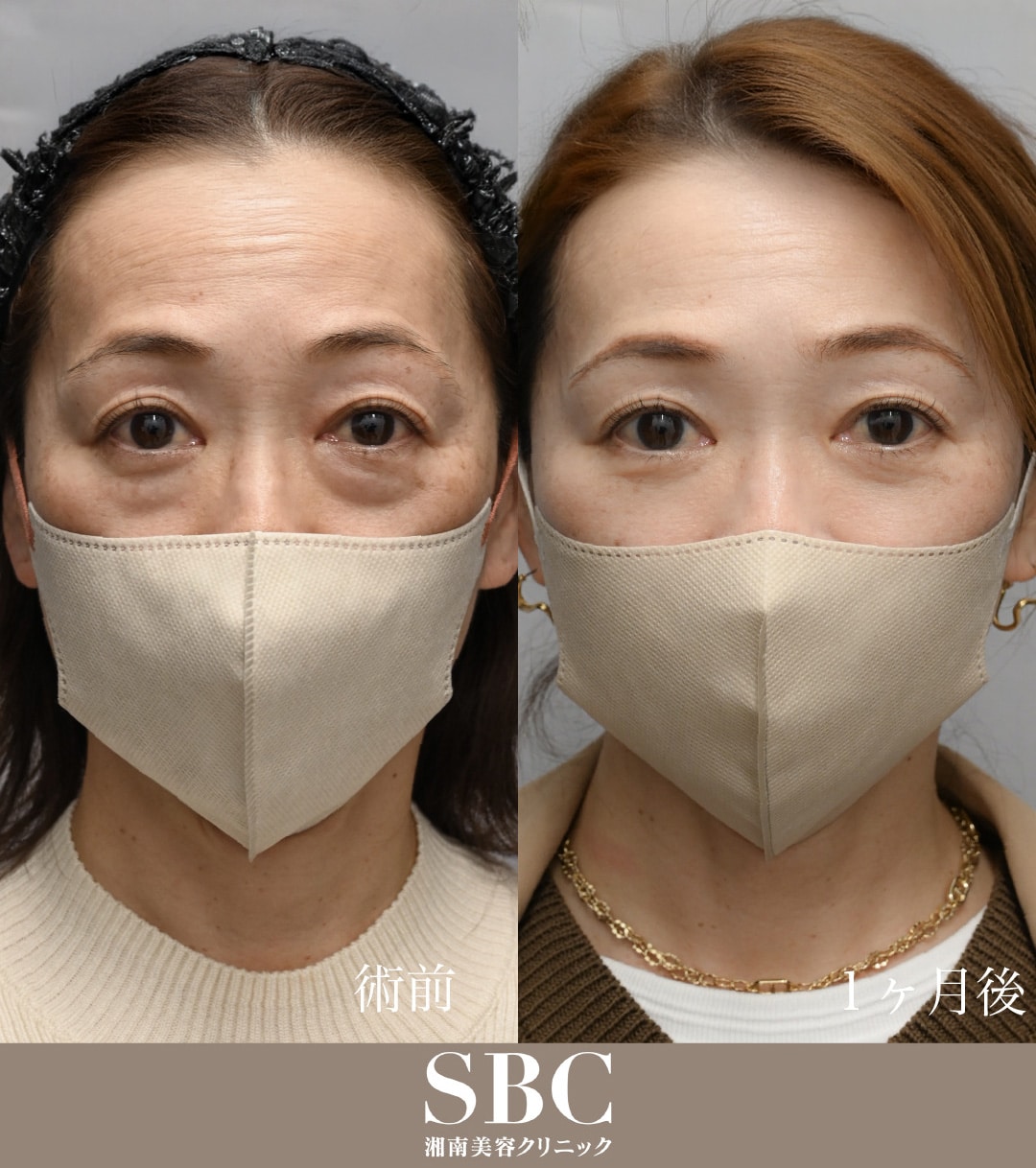 4,500名以上の症例実績！中野医師の症例写真