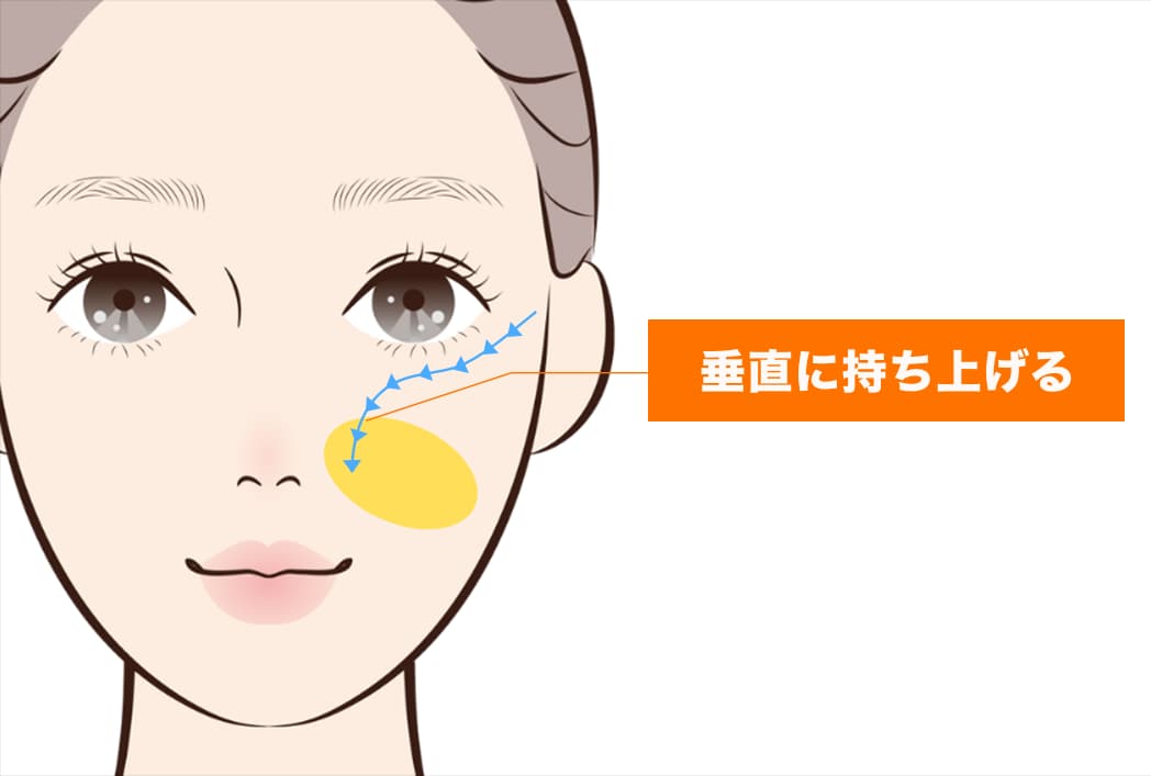 バーティカルリフトとは