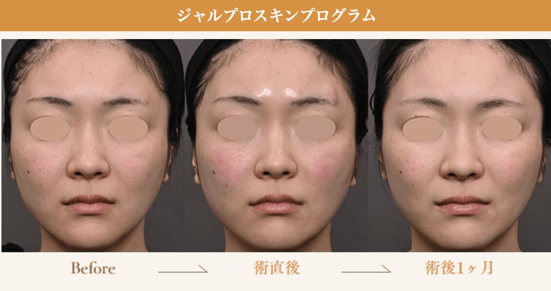 7つの肌質改善効果